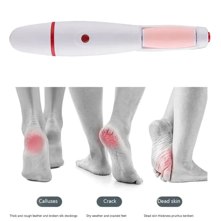 Electric Foot File Grinder - Callus & Dead Skin Remover Pedicure Tool